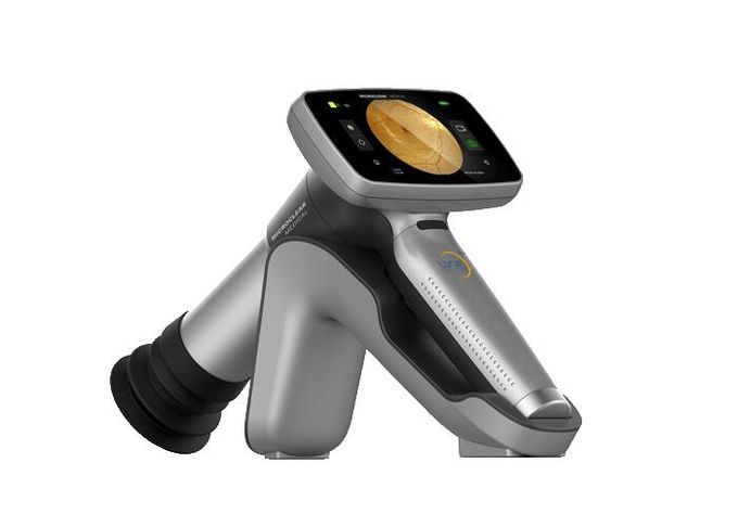 Android System For Easier Operation Hand-held Fundus Camera With Minimum Pupil 2.5mm Image Resolution 1920x1080