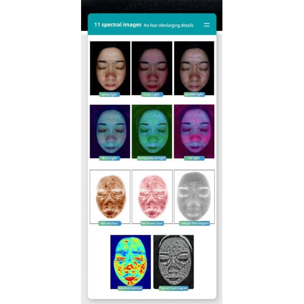 SA-X5 Max 3D AI Skin and Scalp Analyzer system overview