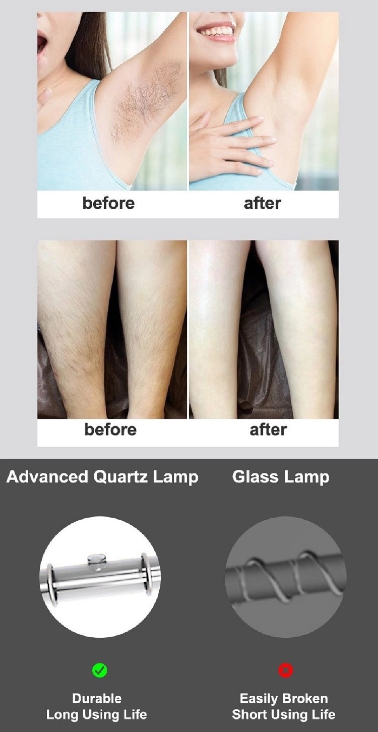 Gold White Whole Body Ergonomic Head 2.6A IPL Laser Epilator