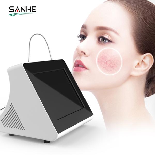 Professional 30W Spider Vein Removal 980nm Diode Laser Vascular Laser Machine