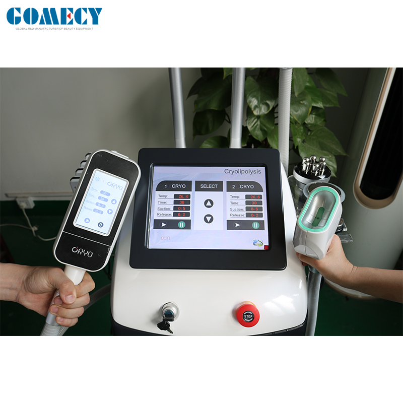 fat loss cryolipolysis