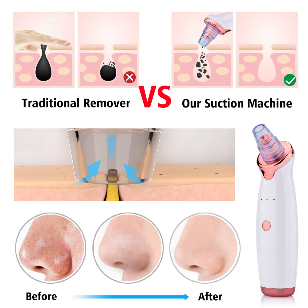 Electric Facial Pore Blackhead Vacuum Suction Remove Machine with 5 Probes Remove Dead Skin Professional Facial Care