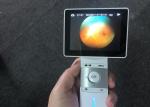 CE Medical Digital Fundus Camera Resolution 1920 X 1080 Pixels