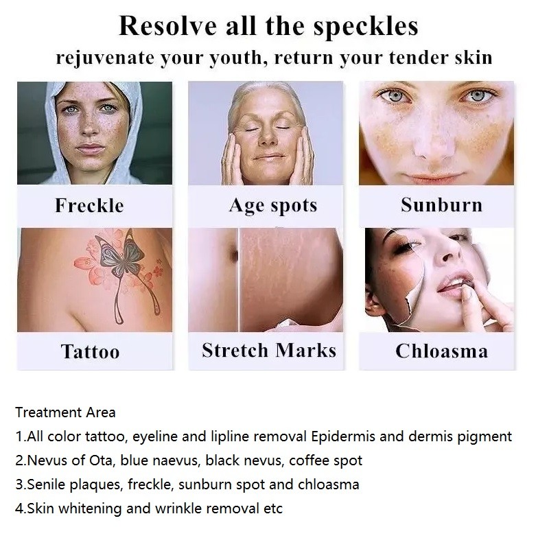808nm Laser Facial Hair Removal Machine Picosecond Pulsed Laser Pigmentation Tattoo Remove