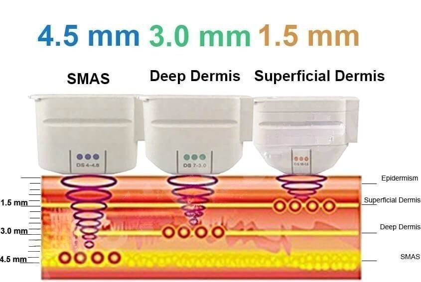 12D CRYOHIFU Hifu Skin Tightening Machine Face Lifting Machine Focused Ultrasound Hifu