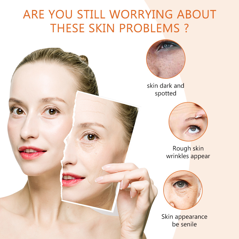 Vitamin C Skin Whitening Face Cream Anti Aging Wrinkle Acne Dark Spot Remover