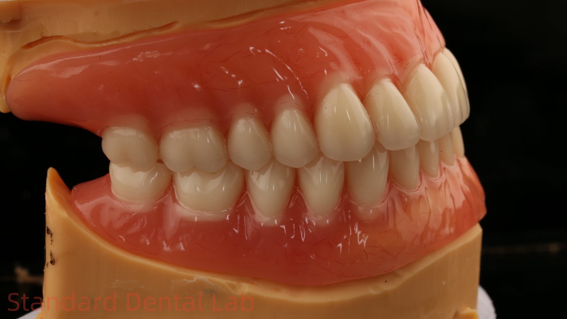 Heat Cured Ivoclar Full Acrylic Denture Dental Lab High Accuracy High Esthetic Advantage