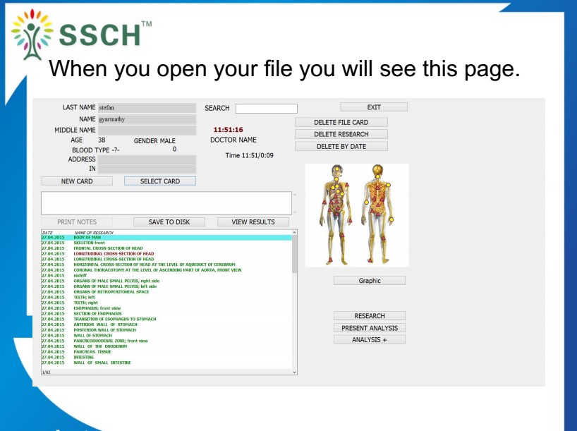 Black Touch Screen 8D NLS Diagnostic Health Analyzer Machine with Treatment for Human Body Check