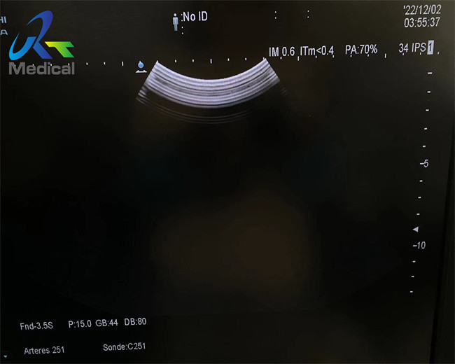 Hitachi Aloka Probe C251 Ultrasound Probe Repair Lens Replacement