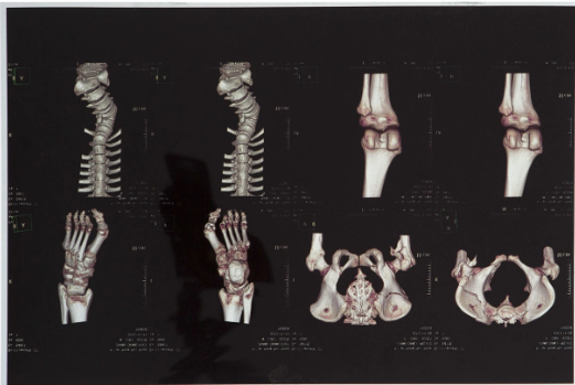 High-clarity Medical X Ray Film FUJI DIHT 14*17in Laser Dry Imaging Film