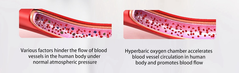 Enhance Metabolism Hyperbaric Oxygen Chamber Mini Single Room WEIZI