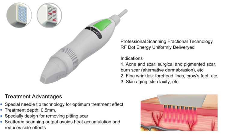 380V Laser Acne Treatment Devices Targeted Therapies For Facial Skin Cure Beauty