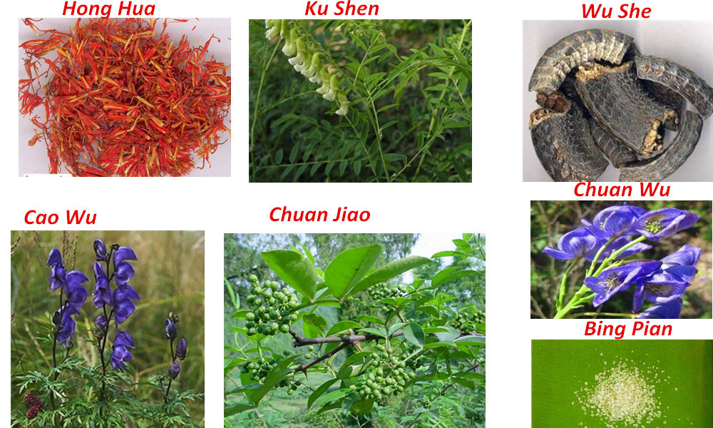 Clear Genital warts removal condyloma treatment herbal product for male sexually transmitted diseases