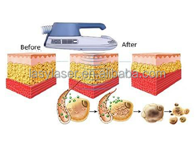 High Frequency Non Invasive EMS Body Sculpting Machine 800w Hiemt Muscle Machine
