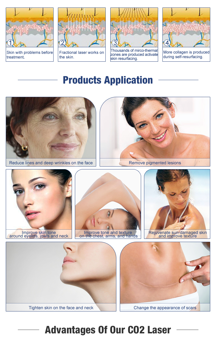 Fractional co2 laser scar removal/Co2 fractional laser /fractional Co2 laser