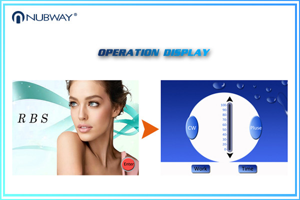 2016 newest red vein reduction truly 30MHZ painless vacular removal devices with CE / FDA specially for clinic use