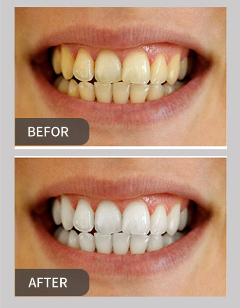 FDA Adult Use Strawberry Flavor Activated Charcoal Teeth Whitening Powder