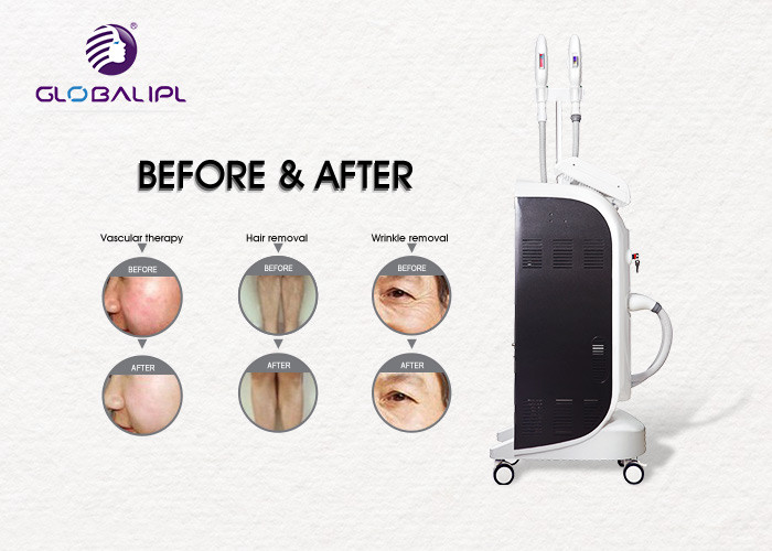 4000W Diode Laser Hair Removal Machine 3 Handle For Salon Usage CE FDA TUV Standard