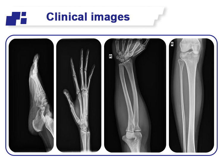 Mobile Portable Digital X Ray Equipment Radiography Diagnosis 100mA LCD Screen