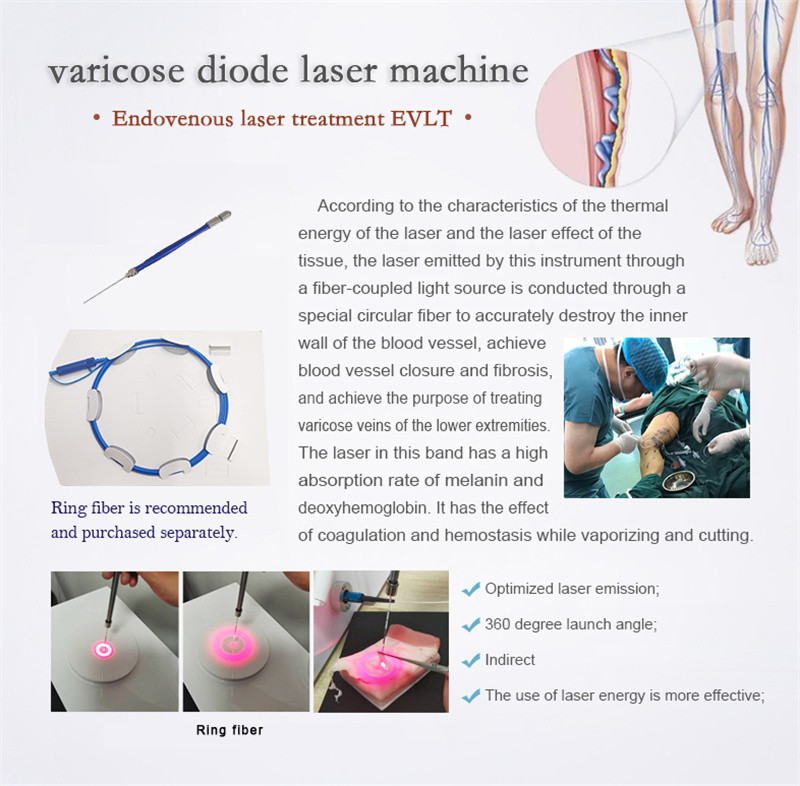 1470 Nm Diode Optical Fiber Laser Liposuction Machine Portable Non Surgical