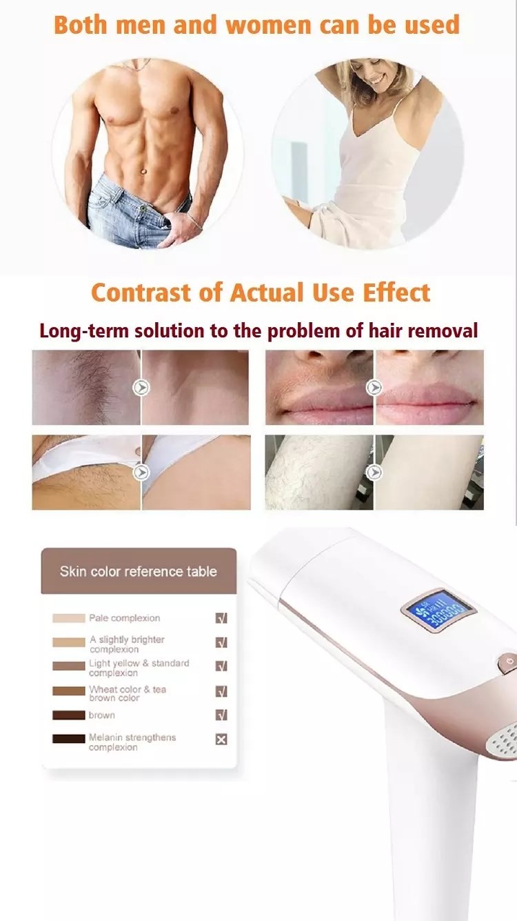 20Min 50HZ 60Hz Full Body Intense Pulsed Light Hair Removal