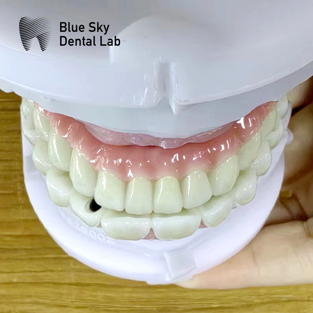 Universal Dental Implant Case Compatible With Multiple Implant Systems