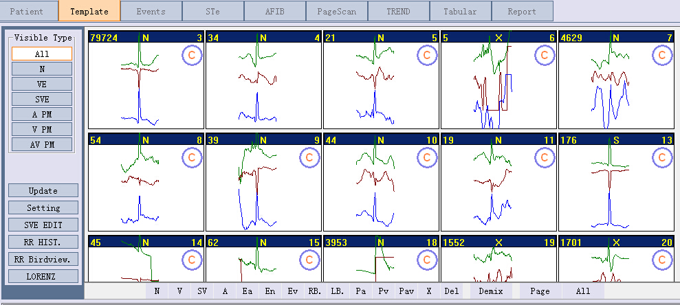 3-CHANNEL HOLTER MONITOR PORTABLE 7 DAYS ECG HOLTER 24H 12-CH iTengo+