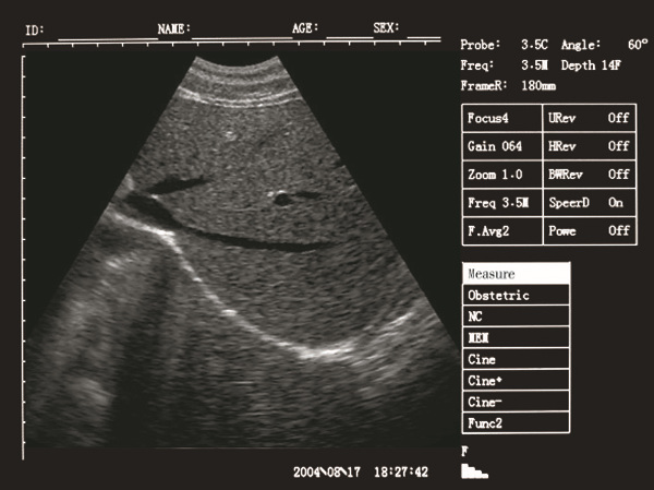 Palm Ultrasound ScannerSU-V5(ultrasonic,black white,Imaging System)