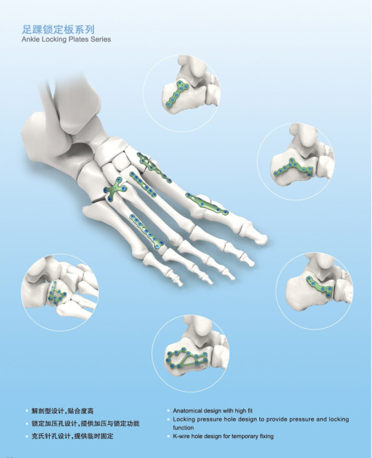 CE 4.0mm HB calcaneal Titanium Bone Locking Plates Type VI