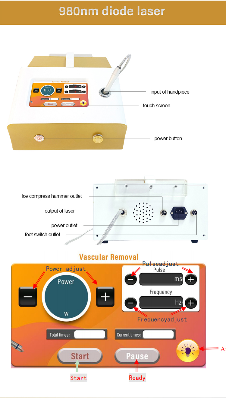 Diode Laser Spider Vein Removal Machine Air Cooling Nail Fungus Treatment 980nm
