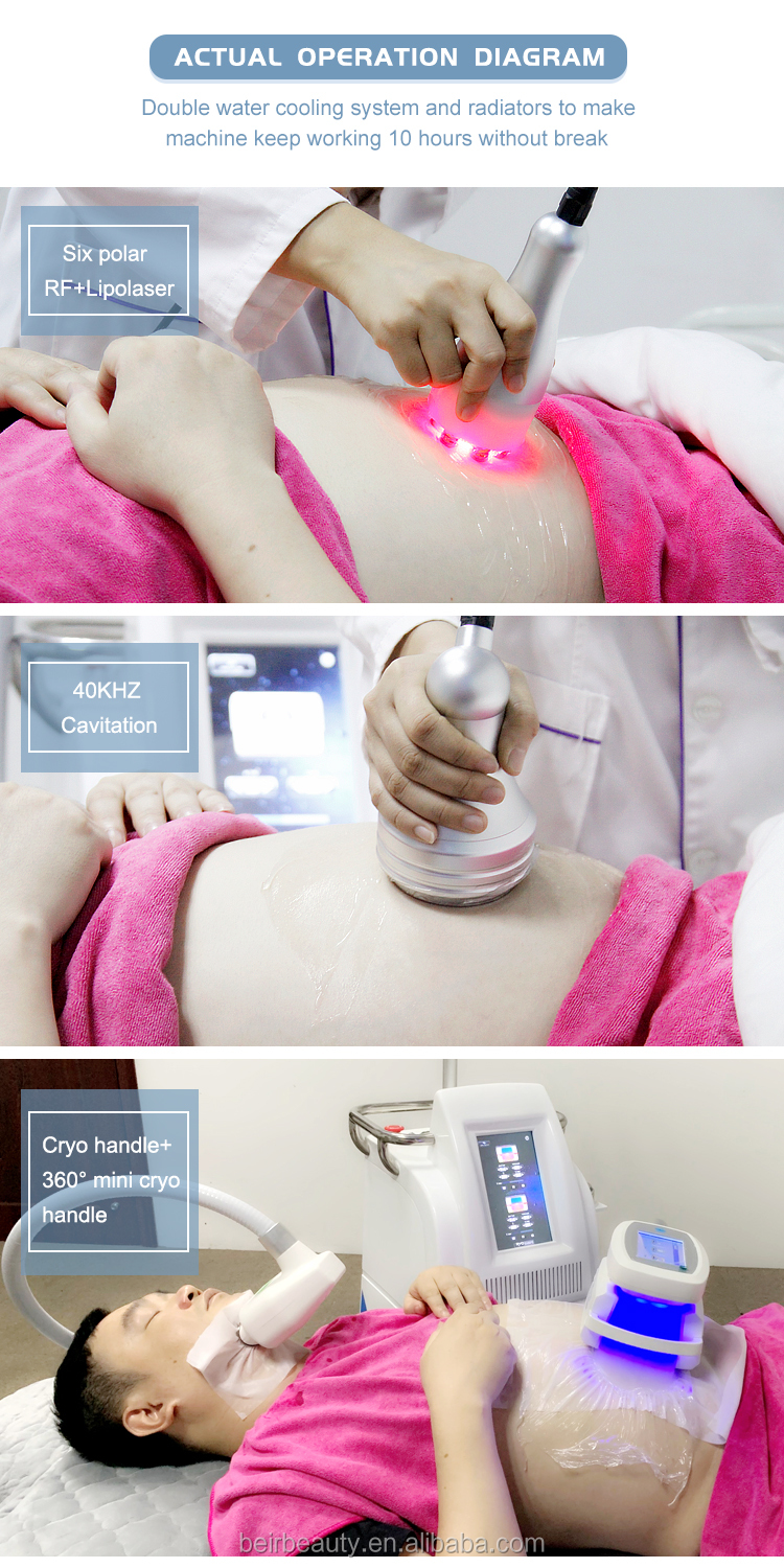 Multifunctional Vacuum Cavitation System With 4 Cryo Handles RF Fat Burning Machine