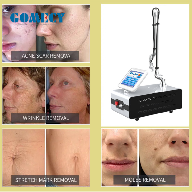 Surgical 10600nm Fractional CO2 Laser System With Max 20*20mm Scanning Area