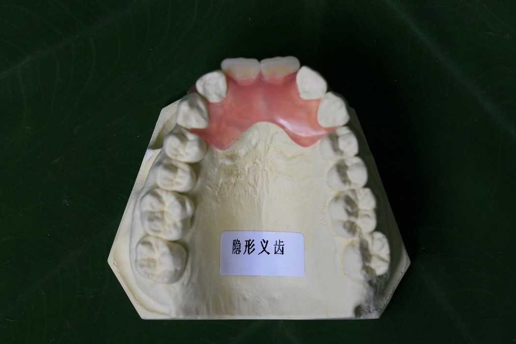 Soft Elastic Nylon Trushine Invisible Denture