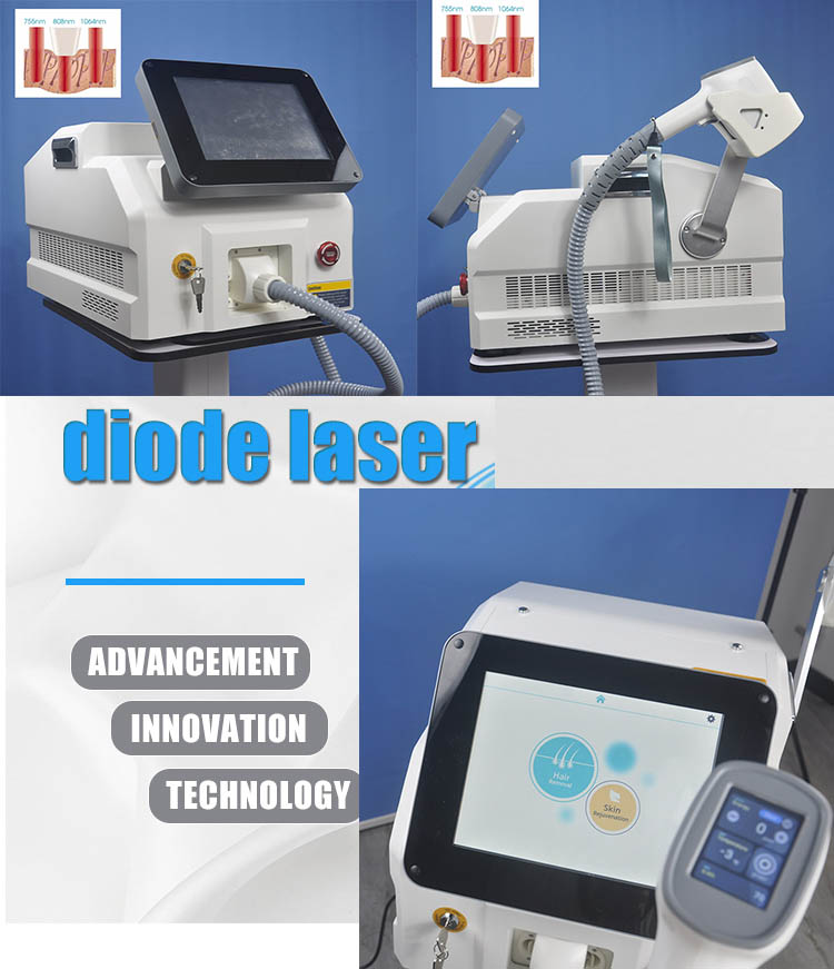 Hair Removal Diode Triple Wavelength Laser , 808 755 1064 Alexandrite Laser Machine