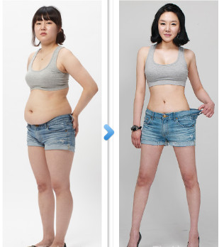 Power Assisted Surgical Vacuum Liposuction Cavitation Machine For Thighs / Arms / Back Treatment