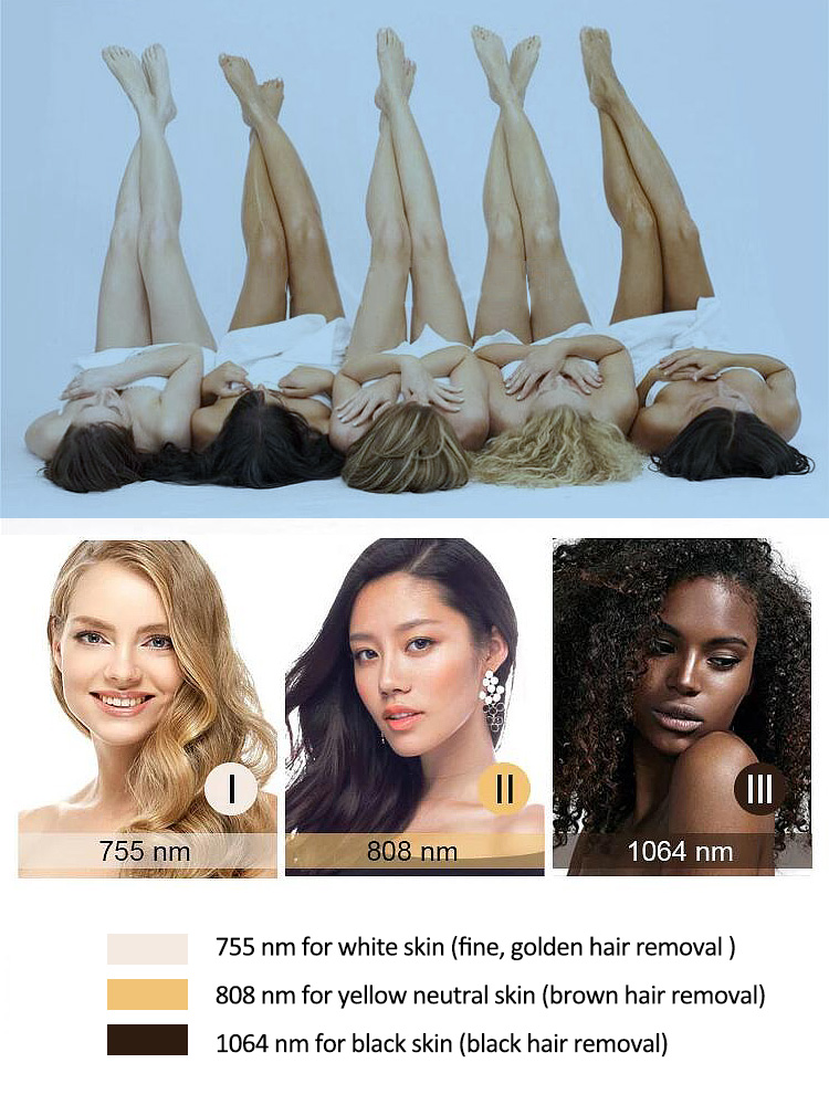 Portable 808nm Diode Laser Hair Removal Machine For Home