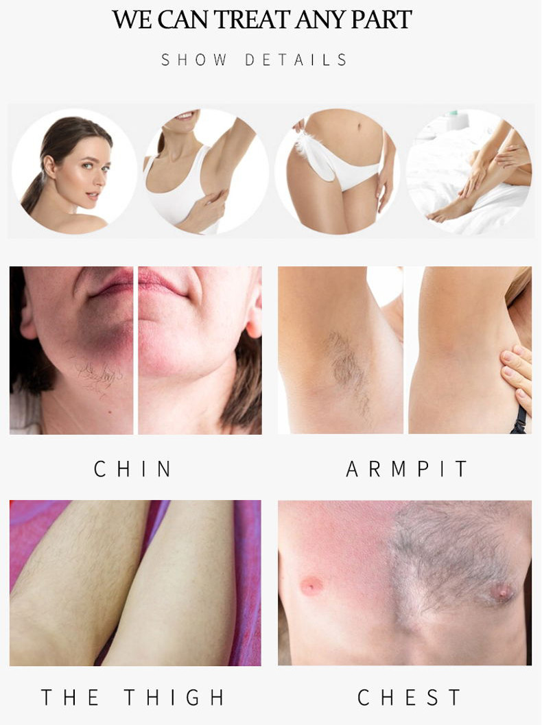 TEC 600W 808 Diode Laser Hair Removal Machine For Skin Tightening