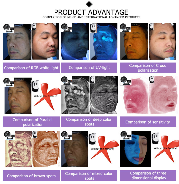 japan software magnifier beauty machine mirrorskin testing 3d digital mobile skin facial analyzer for Skin Mositure