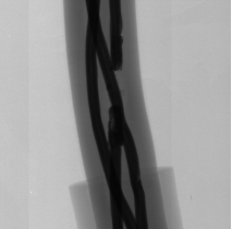 Cable inspection example