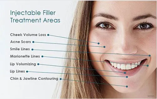 1.0ml Injectable Juvederm Dermal Filler For Natural And Long Lasting Rejuvenation