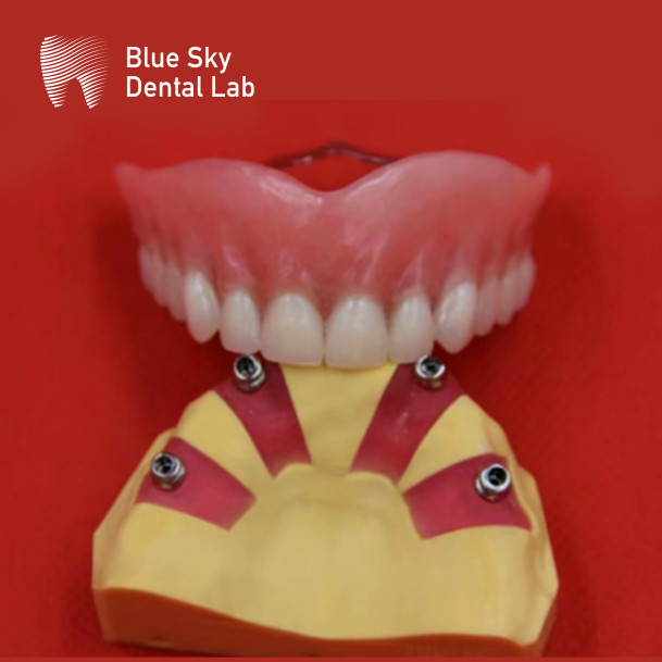 Precision Dental Titanium Bar With Precious Attachment Biocompatible