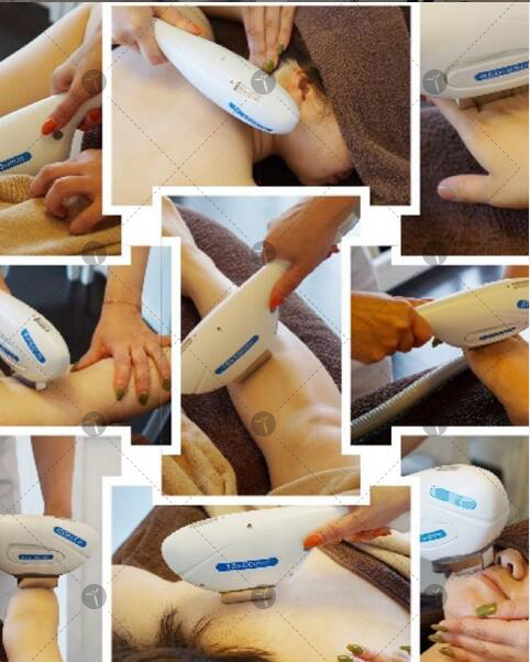 Vertical Multifunction Shr Ipl Hair Removal Machine Acne Treatment