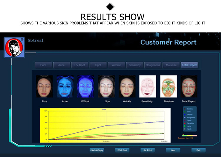 3d nls analyzer skin analysis camera OEM livre download skin analysis software to skin analyzer