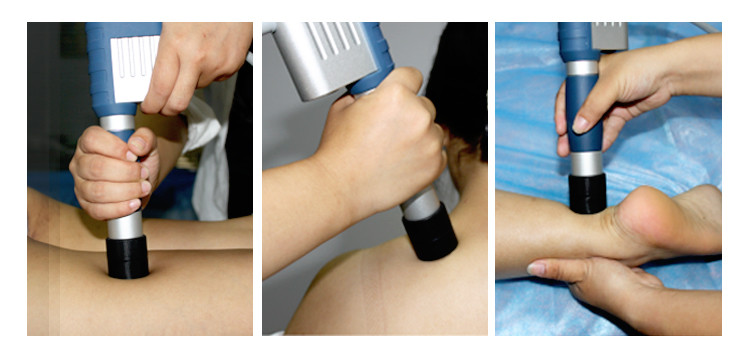 Astiland Pneumatic ED Shockwave Therapy Equipment Medical Pain Relief