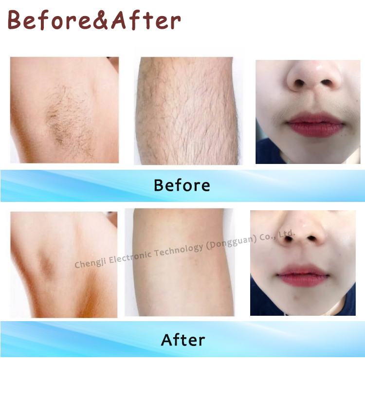 Ice Titanium Laser Beauty Machine 1200w Diode Laser Painless Hair Removal Machine