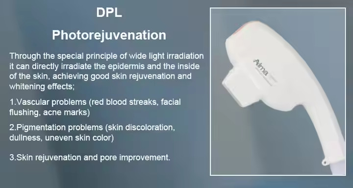 NIR Milk Light Whitening Ice 808nm Diode Laser Device 4 Wavelength 755 808 940 1064 Diode Laser Hair Removal Machine