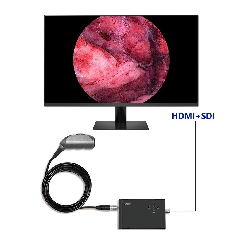 Portable Black FHD 1080P Medical Laparoscopy ENT Endoscope camera system for Animals