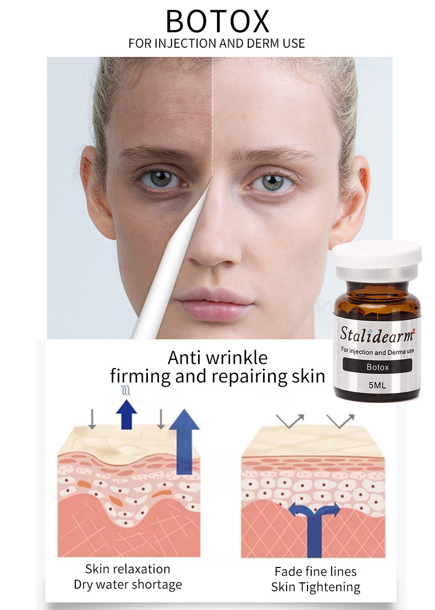 Stalideram Original Botox Injection Meso Therapy For Younger Face Safe Good Natural Effect