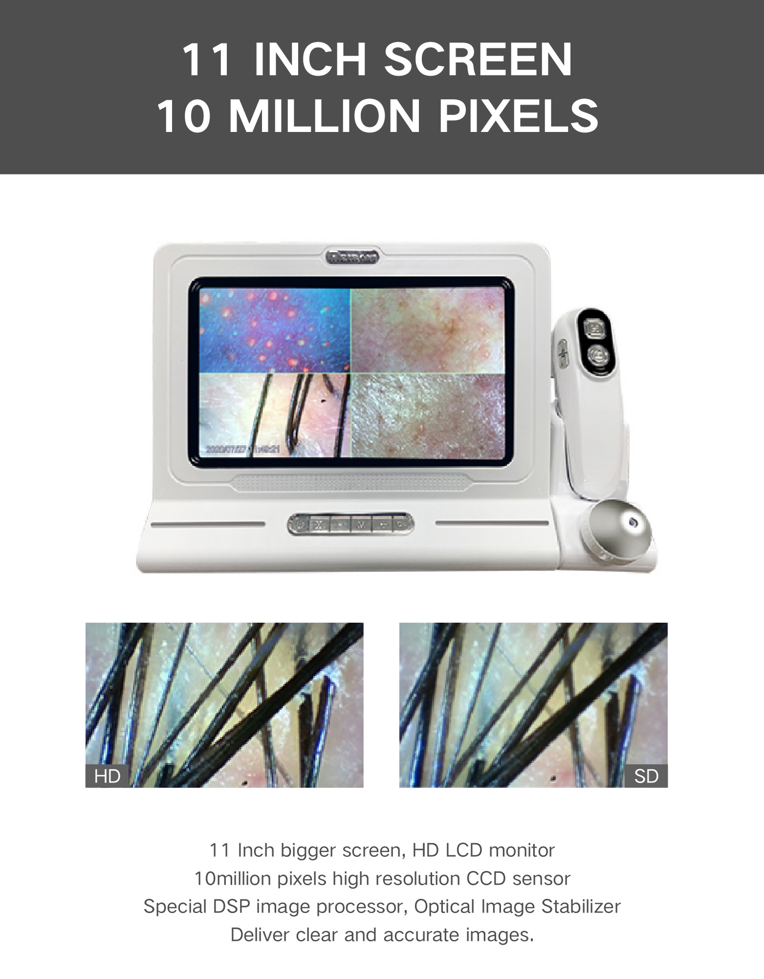 ABS PC 15 Inch HD Screen 200X Camera USB Digital Hair And Skin Analyzer