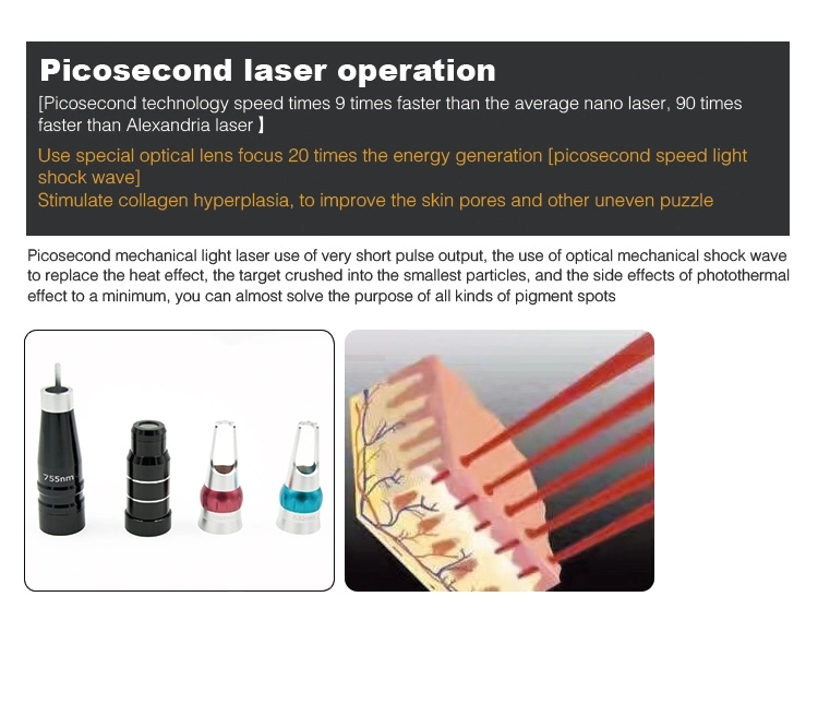 Skin Treatment Pico Laser Tattoo Removal Machine , 2000W Q Switch ND YAG Laser